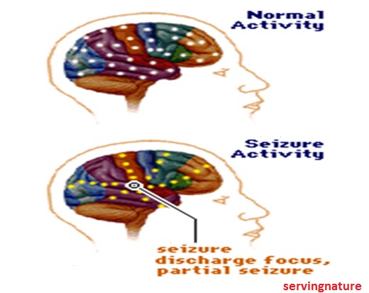 klonopin effects on the brain